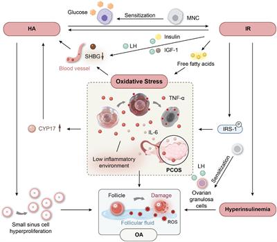 Oxidative stress and antioxidant imbalance in ovulation disorder in patients with polycystic ovary syndrome